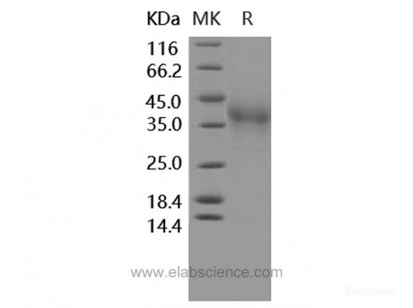 Recombinant Human PD1 / PDCD1 Protein (His tag)