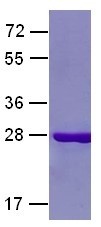 Rab7 Q67L mutant (Member RAS oncogene family, Rab7a, MGC102153), human, recombinant full length, His