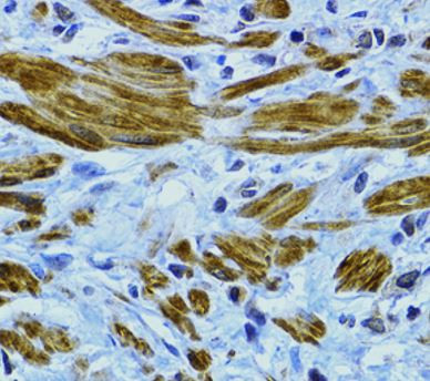 Anti-Desmoplakin I+II