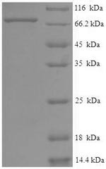 Eyes absent homolog 2 (EYA2), human, recombinant