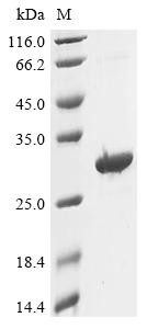Putative ATP-dependent RNA helicase TDRD12 (TDRD12), partial, human, recombinant