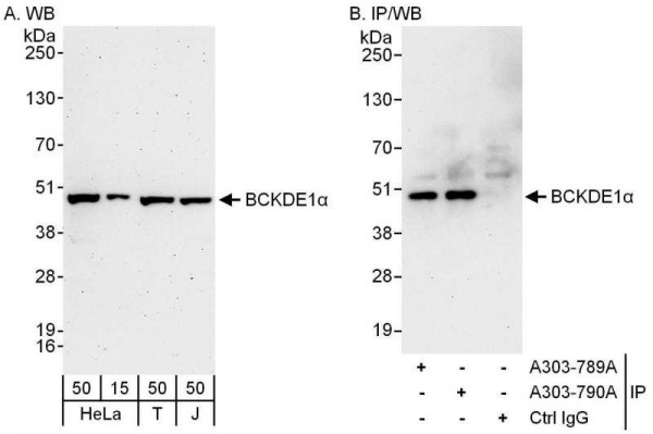 Anti-BCKDE1A