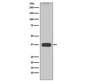 Anti-Arginase 1, clone ADG-1