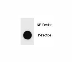 Anti-phospho-c-Kit (Tyr578)