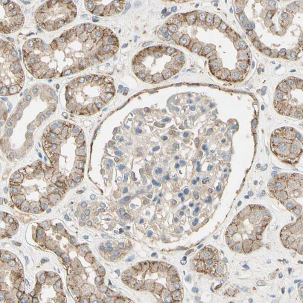 Anti-CDH6