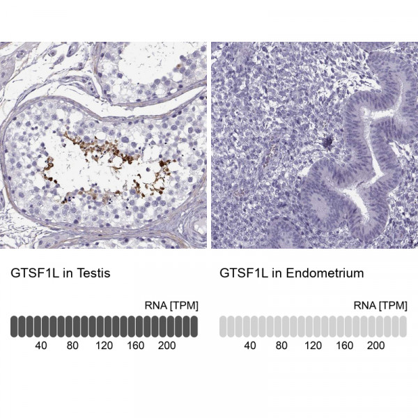 Anti-GTSF1L
