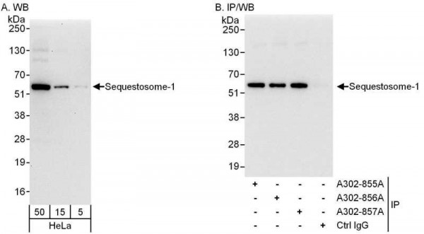 Anti-Sequestosome-1