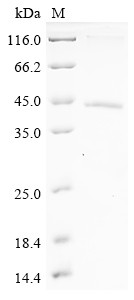 Secreted frizzled-related protein 2 (SFRP2), partial, human, recombinant