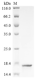 T cell receptor beta variable 19 (TRBV19), human, recombinant