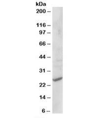 Anti-CYB561D2