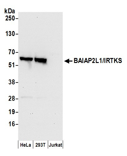 Anti-BAIAP2L1/IRTKS