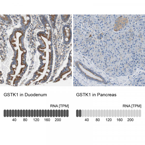 Anti-GSTK1