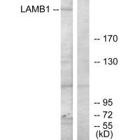 Anti-LAMB1