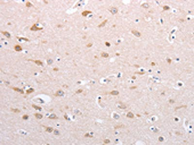 Anti-PFN4