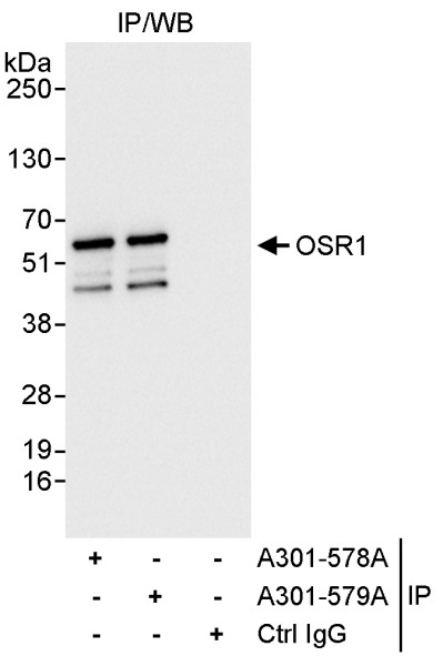 Anti-OSR1