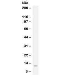 Anti-MGP / Matrix Gla protein