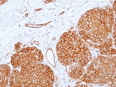 Anti-CD155 [PVR] (human), Rabbit Monoclonal (RM514)
