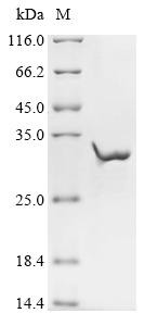 Acetylcholine receptor subunit epsilon (CHRNE), partial, human, recombinant