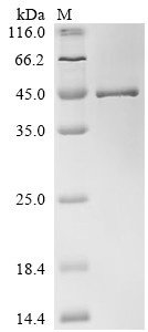 Lipoyltransferase 1, mitochondrial (LIPT1), human, recombinant