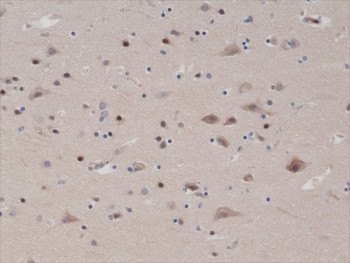 Anti-PTEN, clone RM265 (recombinant antibody)