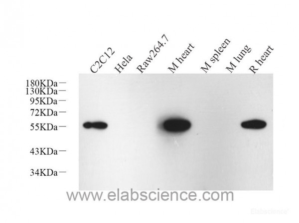 Anti-Desmin, clone 3E1G4