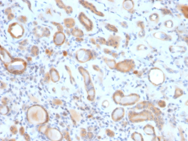 Anti-ARF1 (Golgi Apparatus Marker), clone ARF1/2117