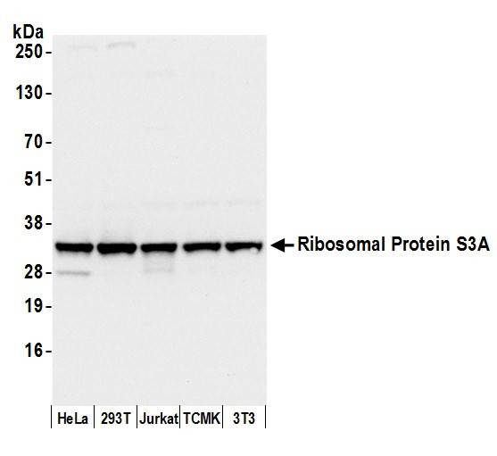 Anti-Ribosomal Protein S3A/RPS3A