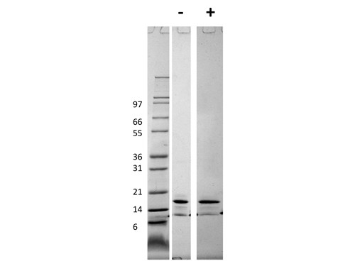 Monocyte Chemotactic Protein-1 (CCL2)