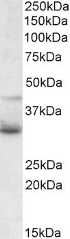 Anti-WNT4, Internal