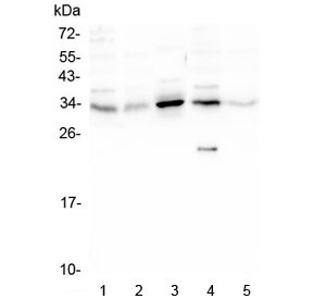 Anti-PPA1 / Inorganic pyrophosphatase
