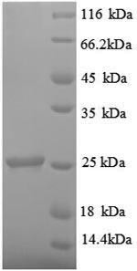 Metalloproteinase inhibitor 1 (Timp1), rat, recombinant