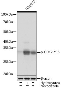Anti-Phospho-CDK2-Y15 Rabbit (CABP1005)