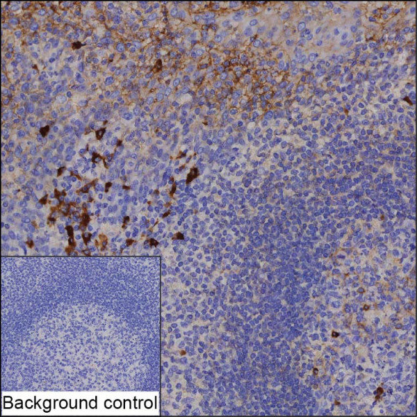 Anti-Anti-Human IgG2