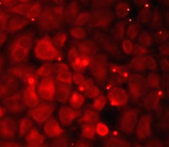 Anti-alpha A Crystallin