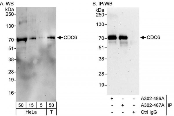 Anti-CDC6