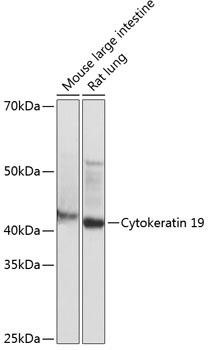 Anti-Cytokeratin 19 (KRT19)