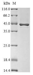 Cell division protein FtsZ (ftsZ), Escherichia coli O157:H7, recombinant