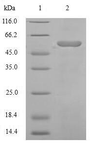Angiotensinogen (AGT), partial, human, recombinant
