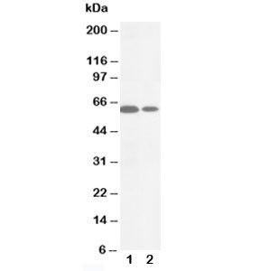 Anti-MMP16