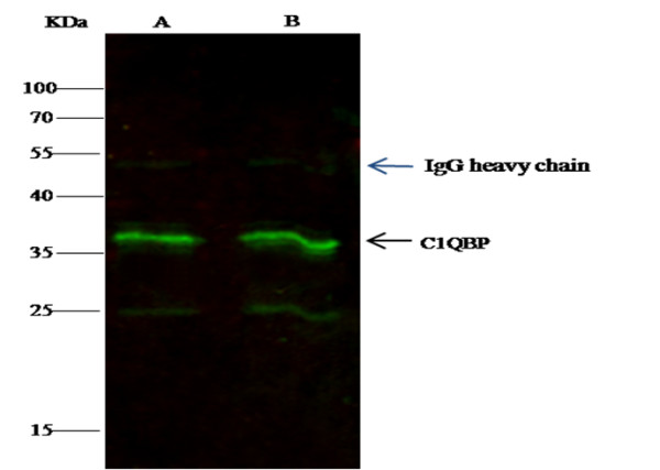 Anti-C1QBP/HABP1 Monoclonal Antibody