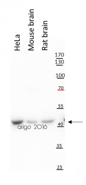 Anti-beta Actin, clone 8F10-G10