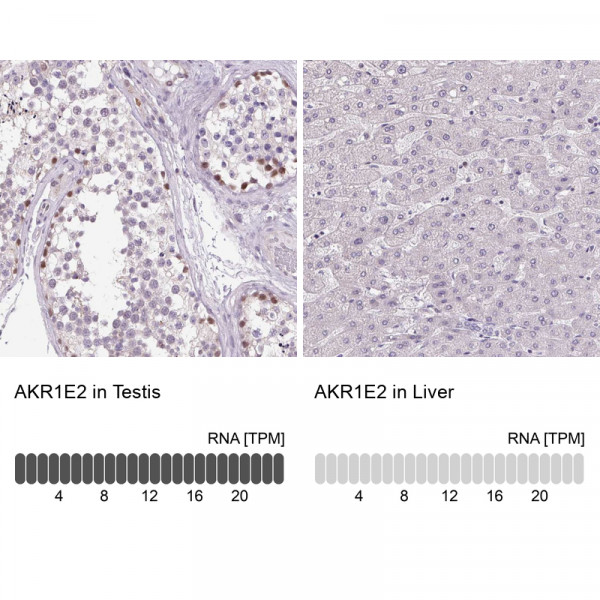 Anti-AKR1E2