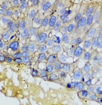 Anti-EpCAM