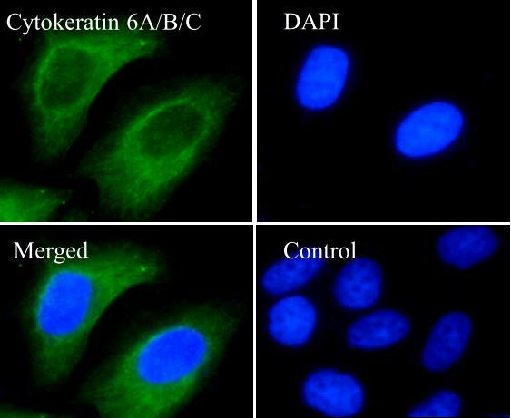Anti-Cytokeratin 6, clone SQab18112