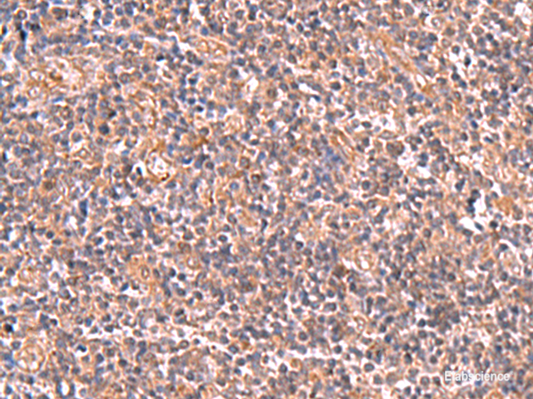 Anti-UBAC1
