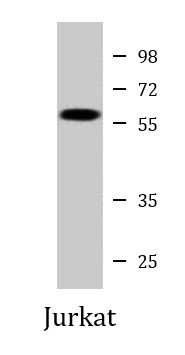 Anti-CREB3L2 / BBF2H7