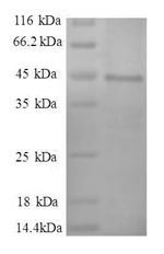 Myosin light polypeptide 6 (MYL6), partial, human, recombinant