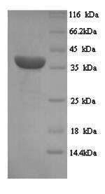 Melanoma-associated antigen 1 (MAGEA1), human, recombinant