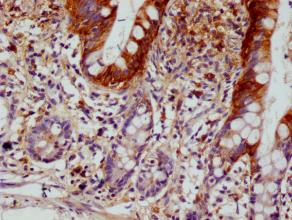 Anti-SCIN Recombinant Monoclonal, clone 12B11