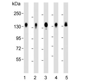 Anti-CD130 / IL6ST / Interleukin 6 Receptor subunit beta